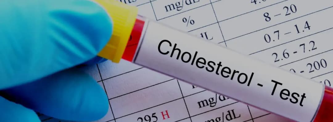 Czy cholesterol jest dziedziczny? Poznaj ryzyko i skutki zdrowotne