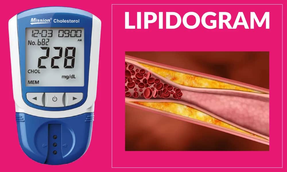 Badania na cholesterol czy na czczo? Kluczowe informacje, które musisz znać