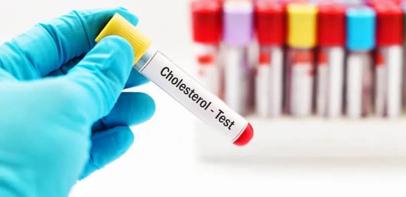 Czy cholesterol rośnie od stresu? Sprawdź, jak stres wpływa na zdrowie